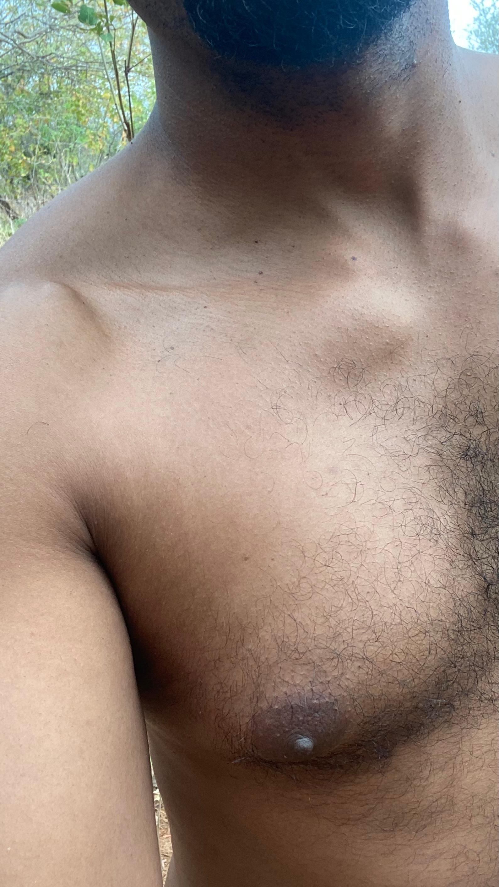 Profile image of negrodovitiligo
